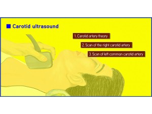 경동맥 초음파