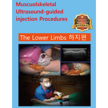 Musculoskeletal ultrasound-guided injection