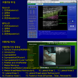 Musculoskeletal ultrasound diagnosis